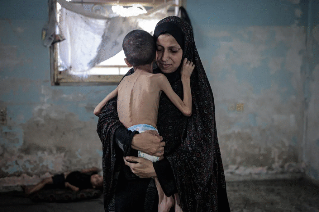 Colapso en el sistema sanitario de Gaza: consecuencias del asedio del régimen sionista israelí
