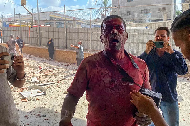 Tragedia en Gaza: Bombardeo israelí al hospital Nasser deja al menos 20 muertos, entre ellos cuatro periodistas